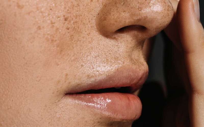 Ausgleichende Hautpflege für Mischhaut: Empfehlungen für einen ausgeglichenen Teint